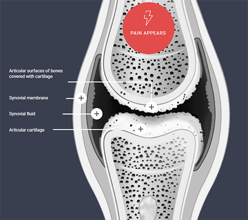Unhealthy Joints